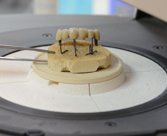 immagine di materiale per odontotecnici